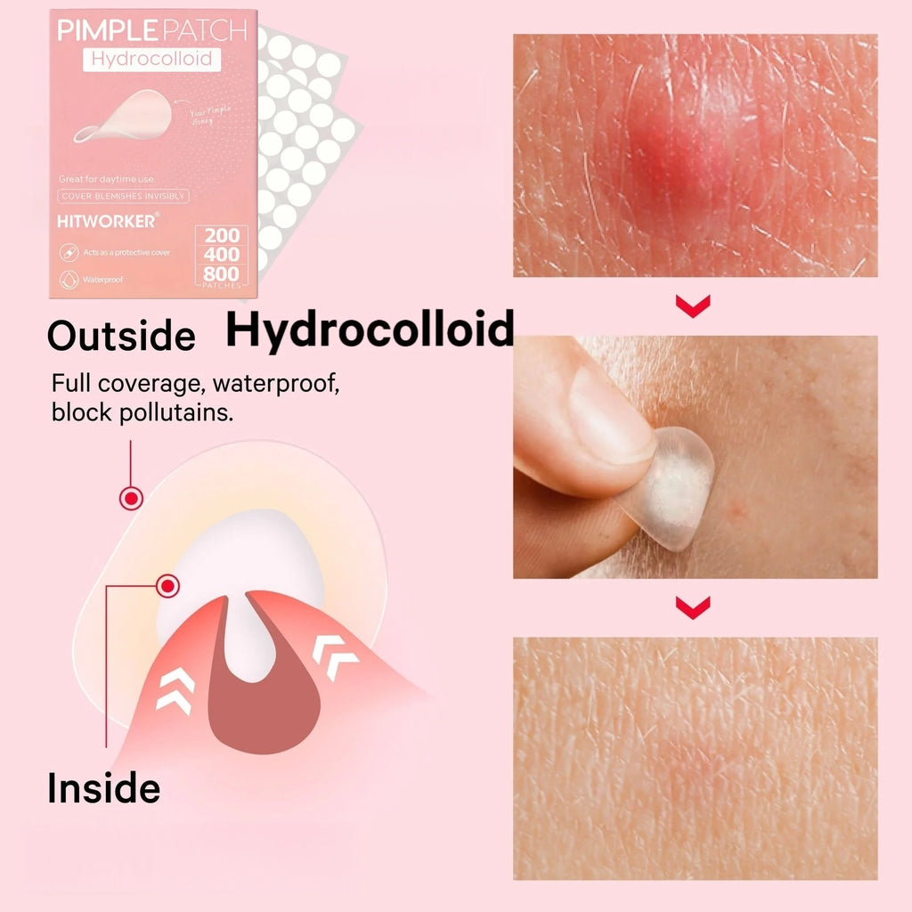200/400/800 Pieces HITWORKER Hydrocolloid Acne Patches - Invisible, High-Quality Pimple Stickers with Salicylic Acid &amp; Tea Tree