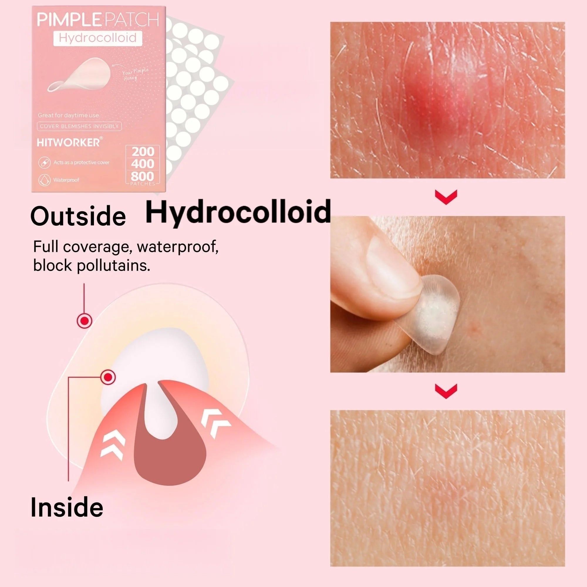 200/400/800 Pieces HITWORKER Hydrocolloid Acne Patches - Invisible, High-Quality Pimple Stickers with Salicylic Acid &amp; Tea Tree
