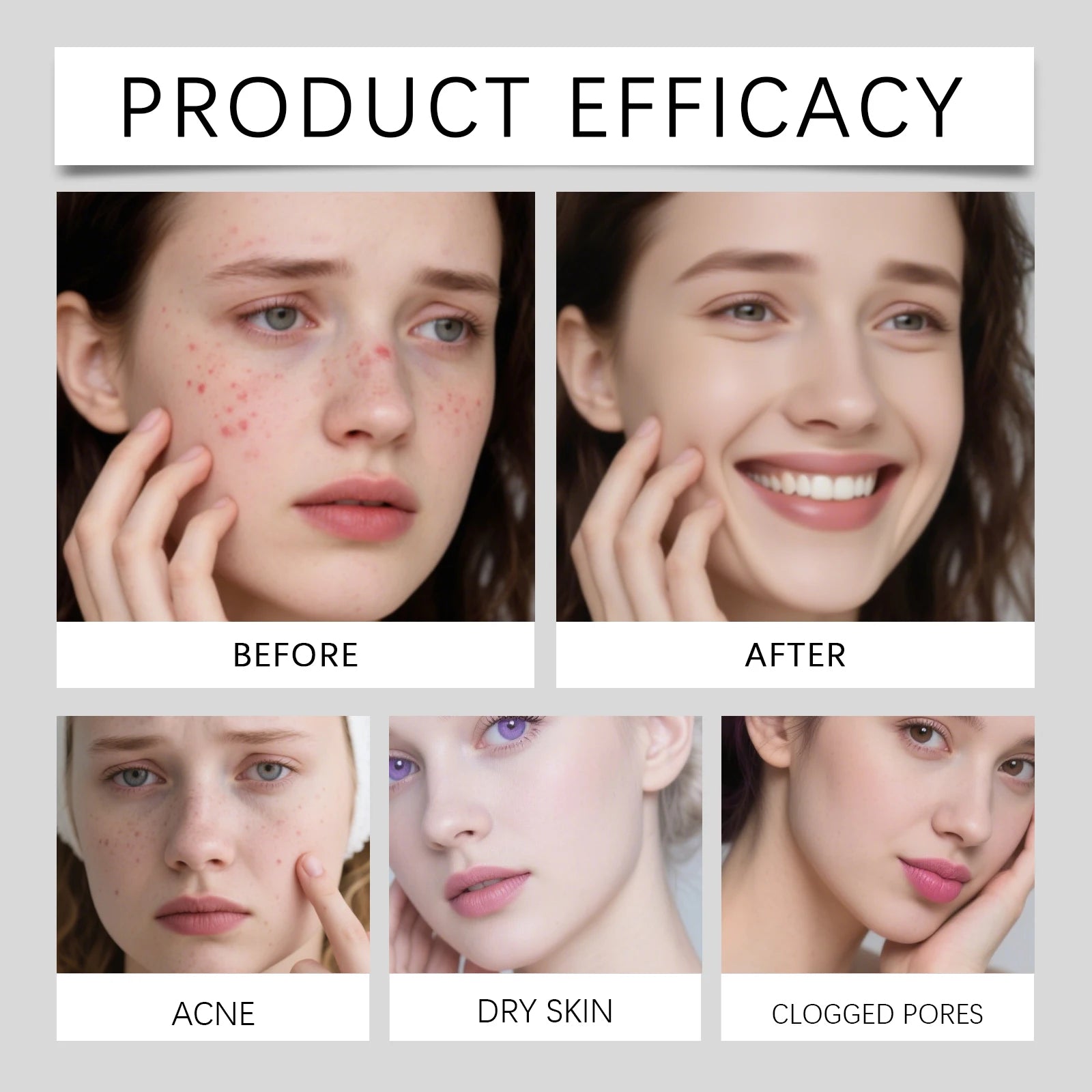 Acne Patches 80 Pcs Salicylic Acid Hydrocolloid Invisible Pimple Patches for Face Blemish Treatment Comedones Care Skin-friendly