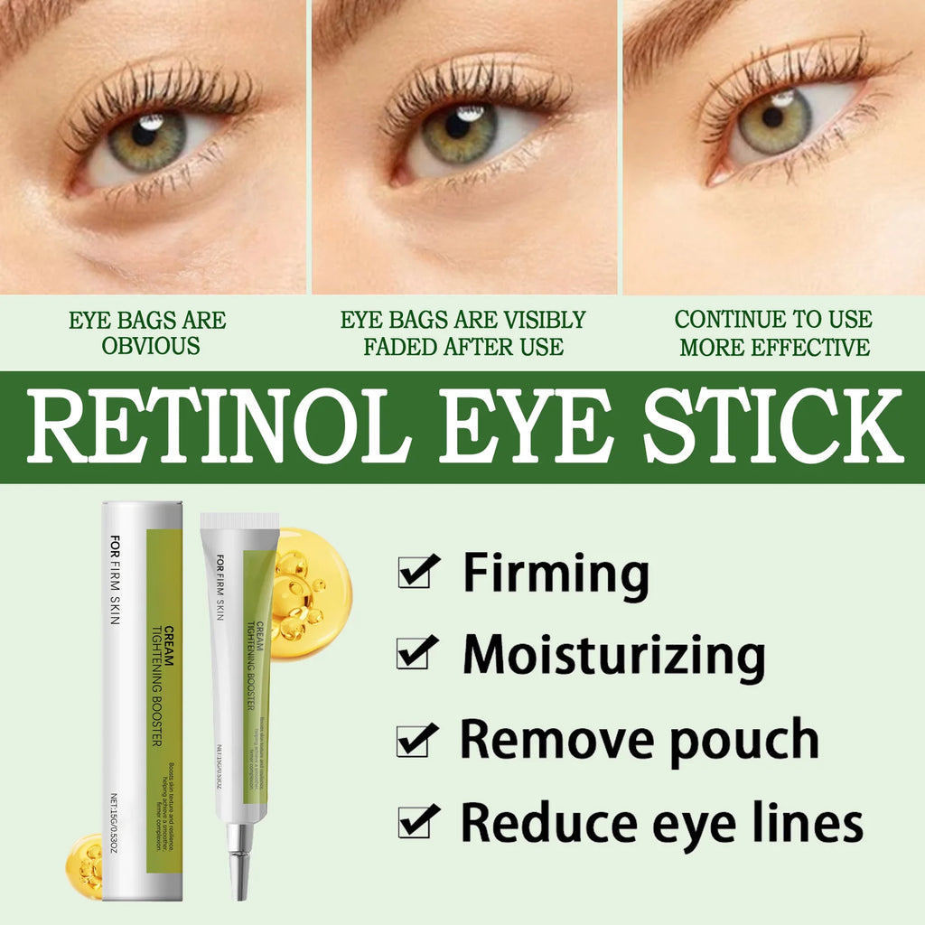 Crème pour les yeux au rétinol ; Crème pour les yeux ; Crème pour les yeux pour les poches et les poches sous les yeux’raffermit la peau,； éclaircissante, gel de soin
