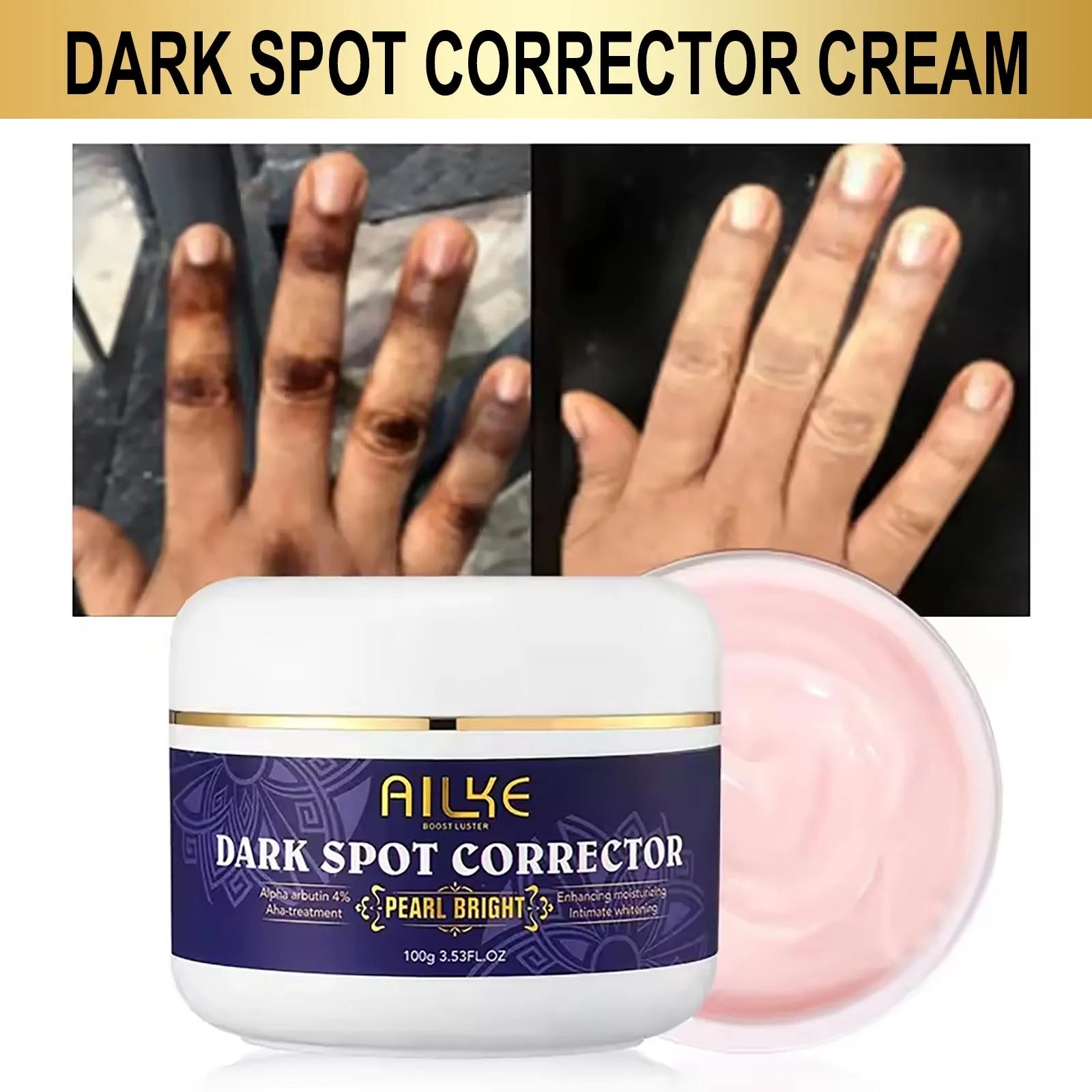 Kit de soins de la peau pour femmes AILKE Glutathione 5-en-1, avec lotion pour le corps, sérum, crème pour l’élimination des taches brunes, crème pour le corps, savon éclaircissant