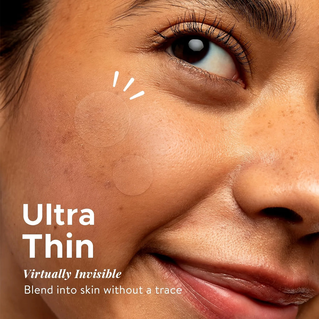 400Count Acne Patch, Covers Pimple And Acne, Acne Pimple Patch for Covering Zits And Blemishes, Spot Stickers for Face And Skin 