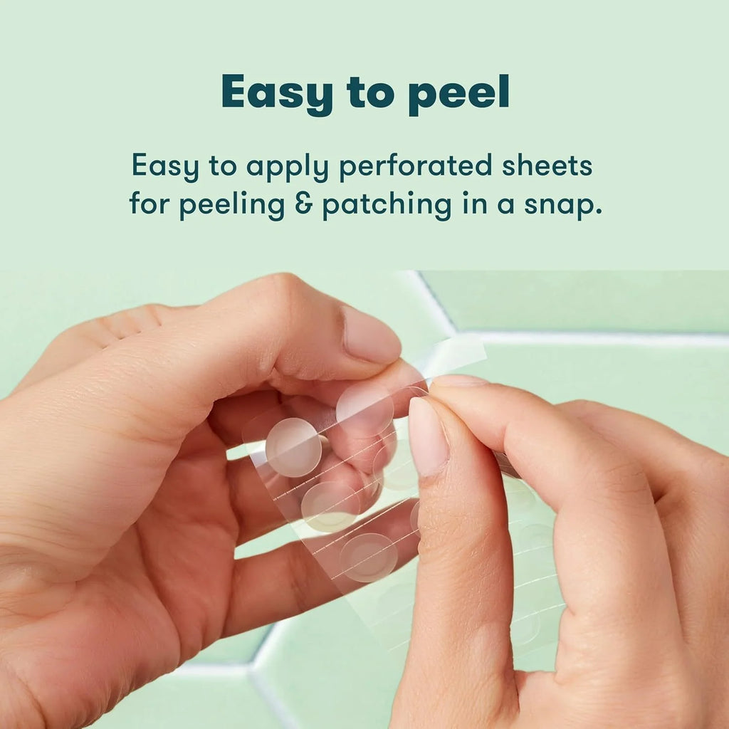 27/54/81-Piece HITWORKER Acne Patches - Infused with Salicylic Acid, Tea Tree Oil &amp; Calendula Oil | For Acne &amp; Blemishes, Residue 