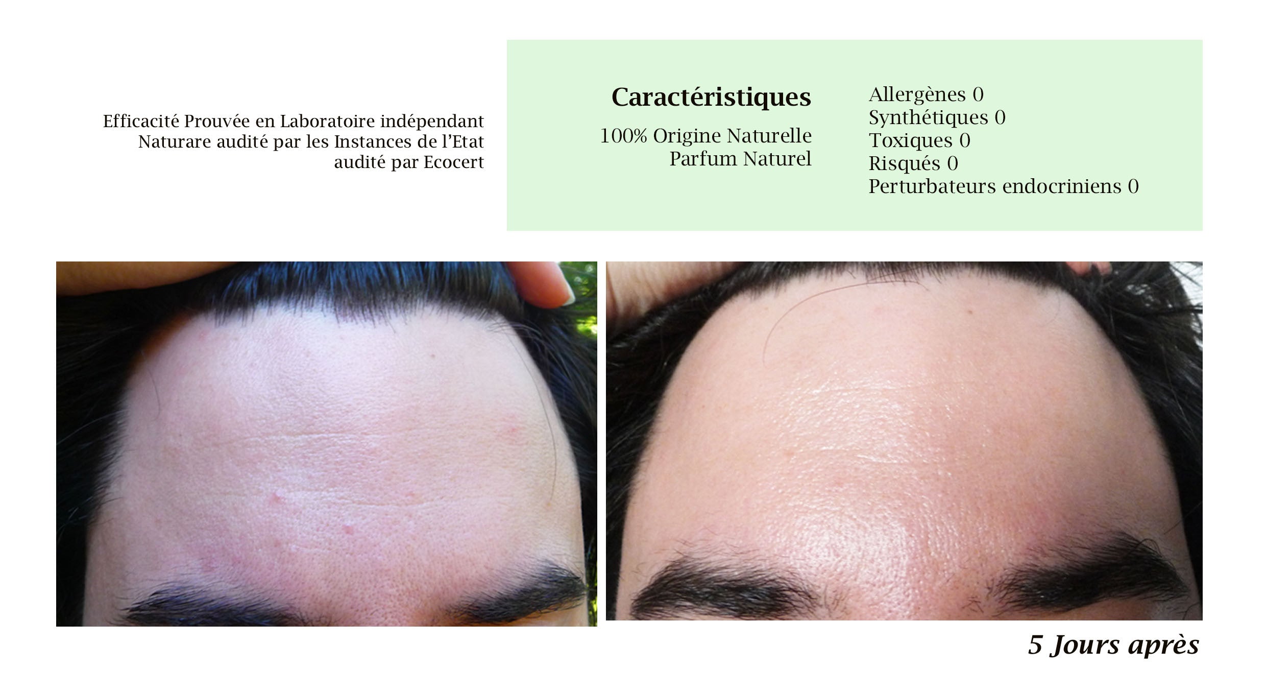 MERVEILLE DES LANDES ORGANIC - Sensitive Skin Care Complete Regeneration Face